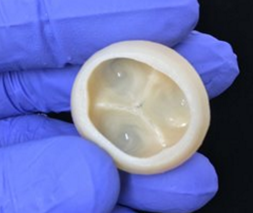 人体组织3D生物打印技术六项研究进展 3 卡内基梅隆大学的科学家们利用3D生物打印技术构造了人体心脏的功能性部件,比如图中的心脏瓣膜。图片提供:卡内基梅隆大学