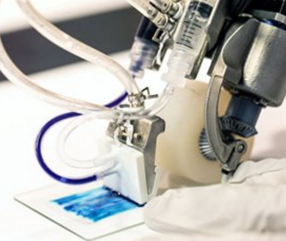 人体组织3D生物打印技术六项研究进展 4 手持式3D打印机将生物材料制成的伤口愈合带覆盖在烧伤伤口上。图片提供:多伦多大学